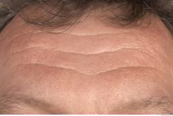 Photo Textures of Human Skin